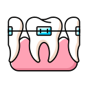 INVISALIGN ALIGNERS | SERVICES | Dr. Dipti's Smile Suite