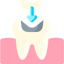 COMPOSITE FILLING | SERVICES | Dr. Dipti's Smile Suite