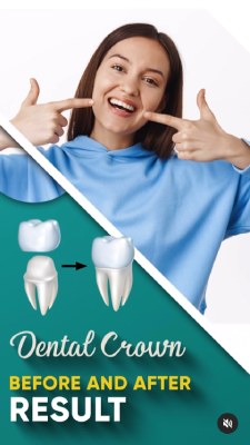 Dental Crown in faridabad